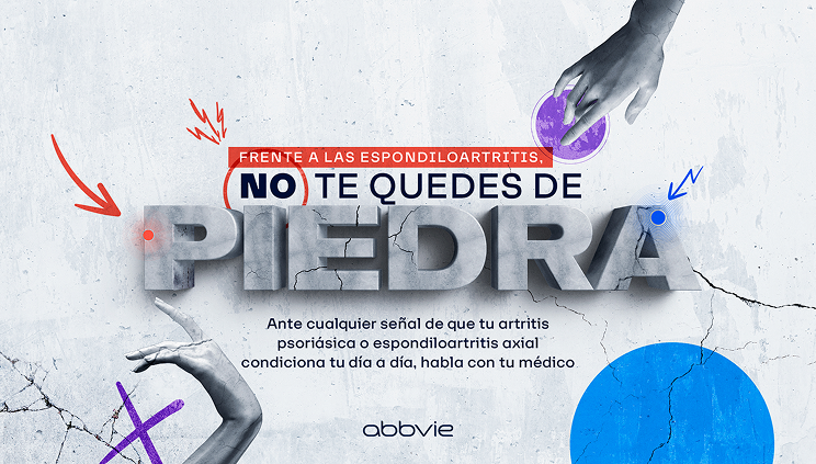 NO TE QUEDES DE PIEDRA