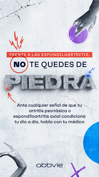 NO TE QUEDES DE PIEDRA