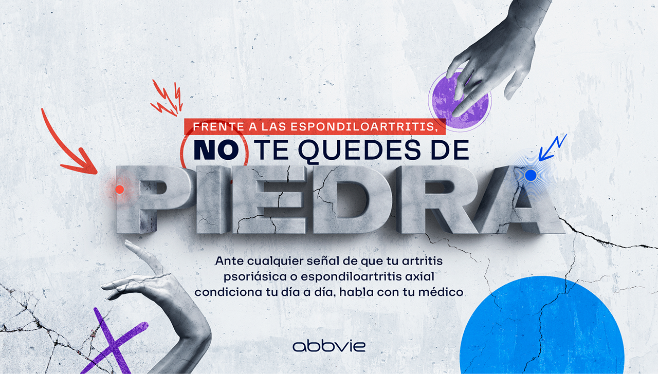 NO TE QUEDES DE PIEDRA